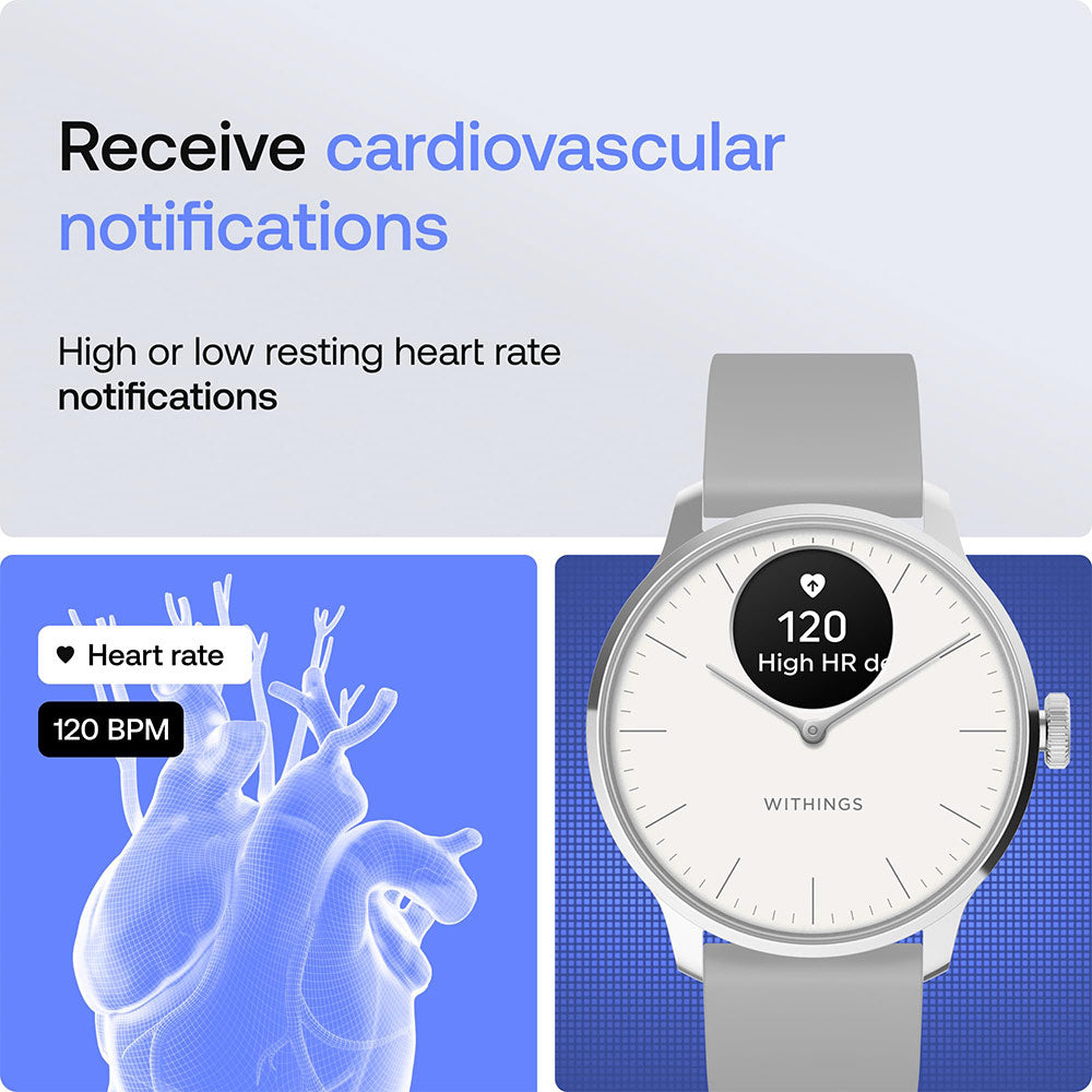 Withings ScanWatch Light - Hybrid Smartwatch